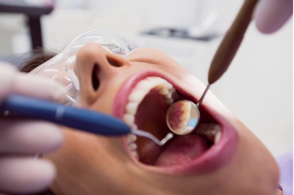 Лечение корневых каналов зуба: всё, что вам нужно знать