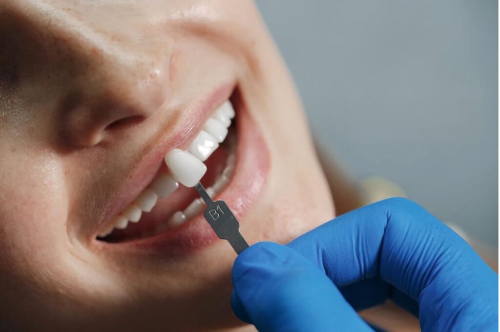 Искусство реставрации зубов: новейшие методики возвращения красоты улыбки